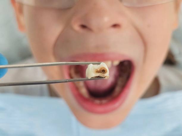 Best Dentist for Dental Trauma  in Carlisle Rockledge, AL